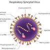 RSV cases are on the rise in which FDA took actions by releasing vaccines for the said illness. (Photo: Pediatric Pulmonologists)