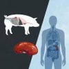 Pig kidney transplants are now close to becoming a real thing as trials have improved. (Photo: Vox)