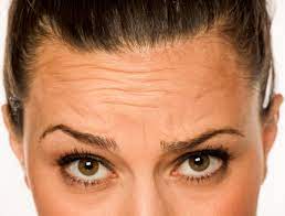 Reduce wrinkles by following these easy steps. (Photo: Skin Institute)